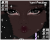 T|Yumi Freckles