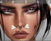 A| Bone Septum