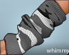 whimmyarms