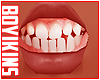 ☀. Kid Teeth 06