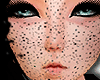freckles-espancion