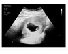 6wk ultrasound print