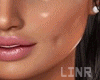 Dimples Cheek  Marks