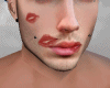 llzM.. Marked Kiss