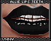 V4NY|Allie Lips Teeth2