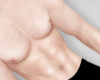 Rk| Albino Skin Roa Ast
