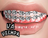 va. braces M