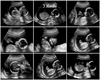 Custom Ultrasound Pics