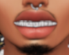 Icy Grillz