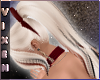 Calico; Wynter