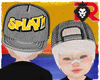 🦁 Albino HAT