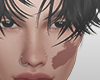 . birthmark .