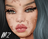 Sandy Vitiligo T2
