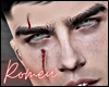 Vamp Scars