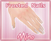 ᶬ Nails l Frosted