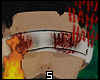 blood eye bandage
