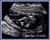 Tru Ultrasound Pic