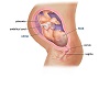 (ALC} 9 Month Fetus