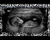 Ultrasound Pic 2