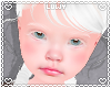 Kid 🐰 Kimi Albino