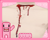 bleed4U