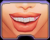 Diamond Grillz