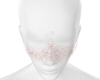 Freckels