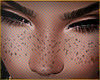 FRECKLES