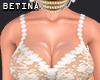 BT*F Lace Dress