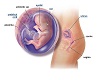 {ALC} 3 Month Fetus