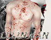 LLLbloodstains skin