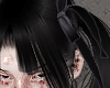 black bows