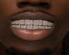 gold invisable set
