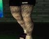 hairy legs