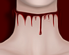 choker blood