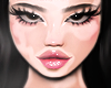 !!♡ cuteee vitiligo
