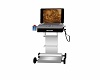 Portable Ultrasound Mach