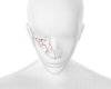 Face Raio Cicatriz