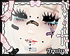 hurt