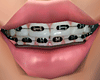 Black Braces .