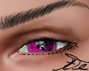 A- Pink Eye M
