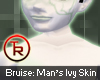 Bruise: Man's Ivy Skin
