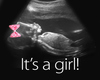 Baby Girl HH Ultrasound