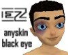 (djezc) anyskin blackeye