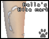 Bella's Scar