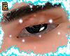 baggy eyes