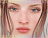 A | Zell freckles mh N/L
