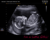 Custom girl ultrasound