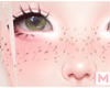 x HD Freckles