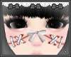 stitches V2